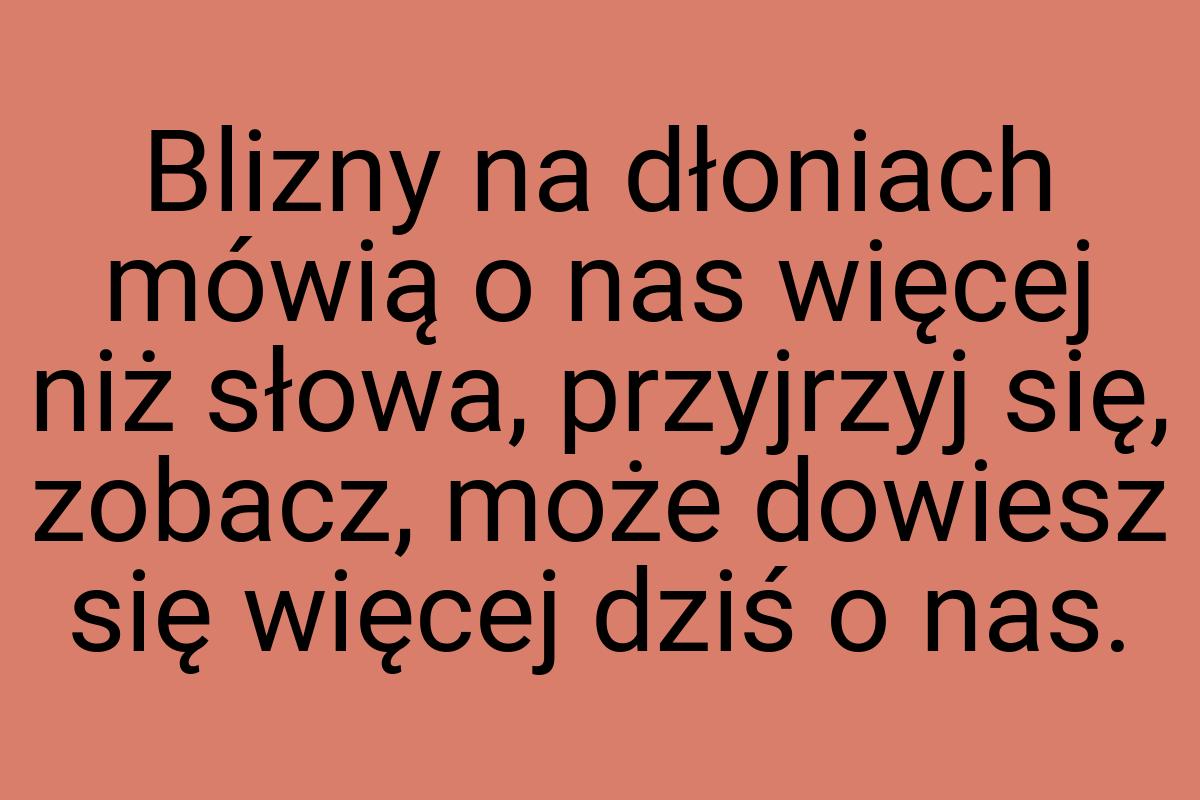 Blizny na dłoniach mówią o nas więcej niż słowa, przyjrzyj