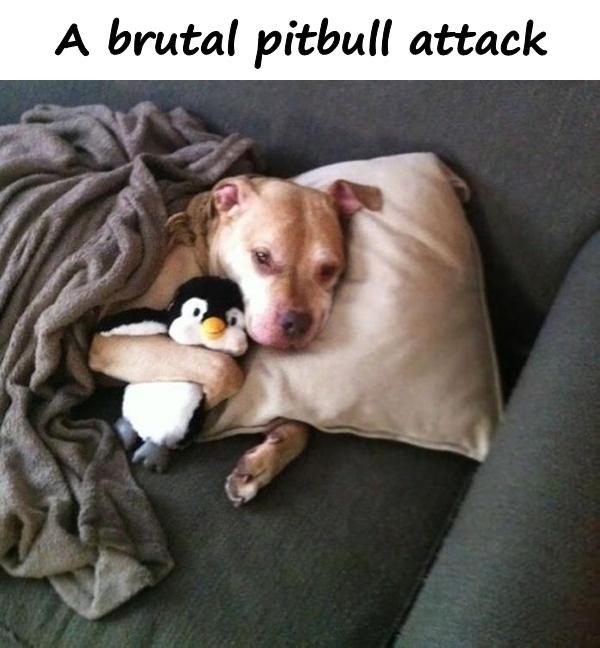 A brutal pitbull attack