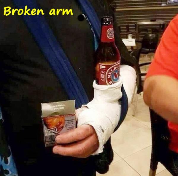 Broken arm