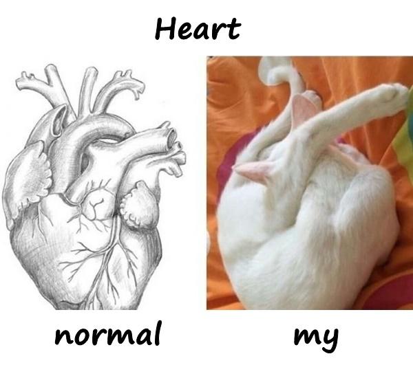 Heart - normal vs. my