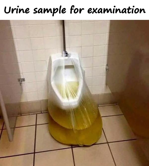 Urine sample for examination