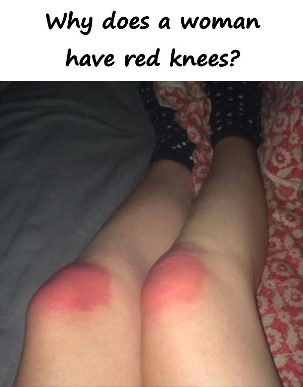 Why does a woman have red knees