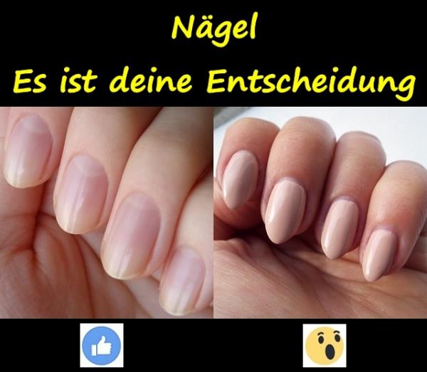 Nägel. Es ist deine Entscheidung