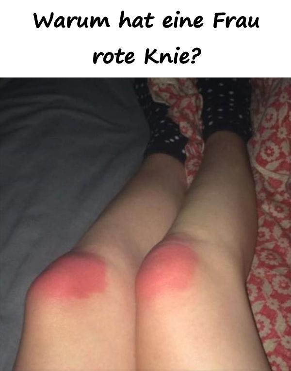 Warum hat eine Frau rote Knie