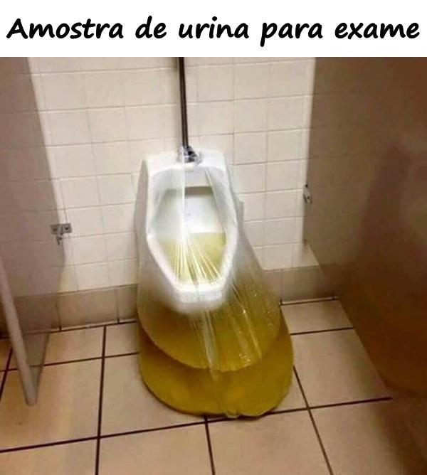 Amostra de urina para exame