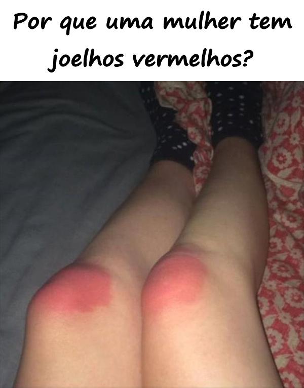 Por que uma mulher tem joelhos vermelhos