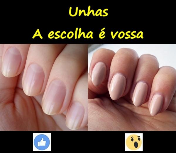 Unhas. A escolha é vossa