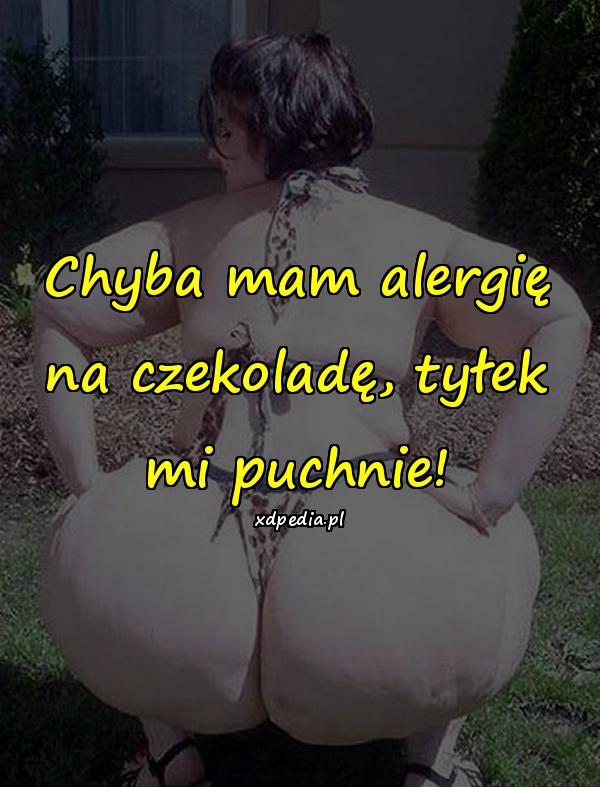 Chyba mam alergię na czekoladę, tyłek mi puchnie