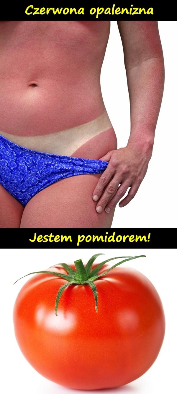 Czerwona opalenizna. Jestem pomidorem