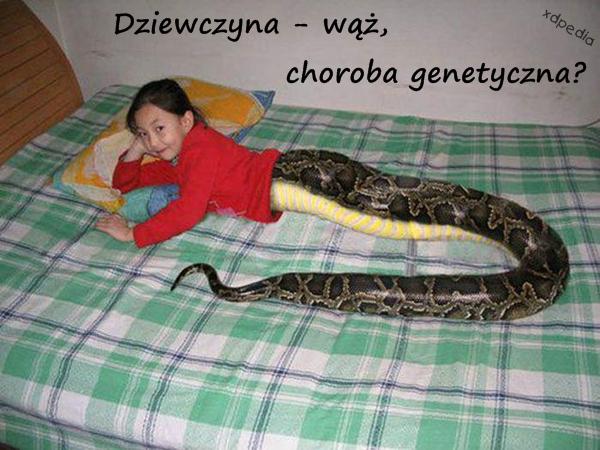 Dziewczyna - wąż, choroba genetyczna