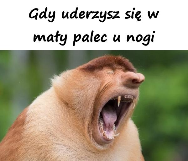 Gdy uderzysz się w mały palec u nogi