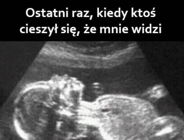 Ostatni raz kiedy ktoś cieszył się, że mnie widzi