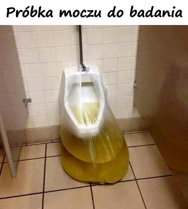 Próbka moczu do badania