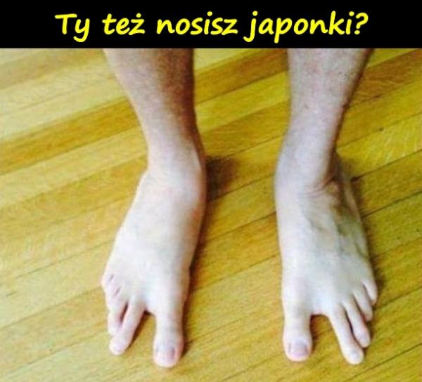 Ty też nosisz japonki