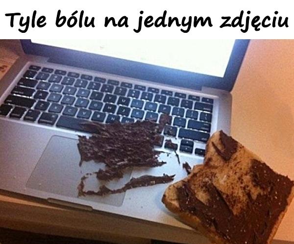 Tyle bólu na jednym zdjęciu